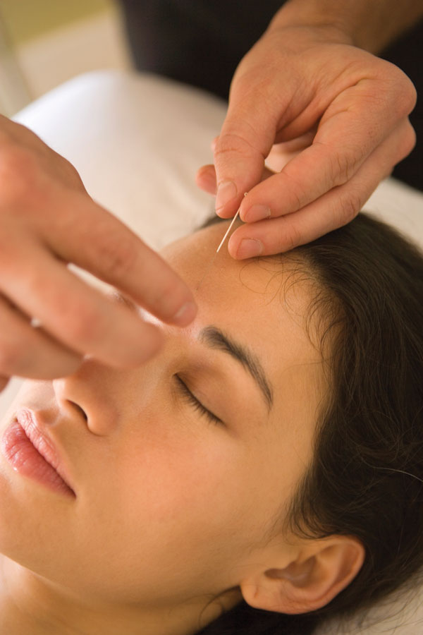 Acupuncture and moxibustion