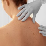 skin-check