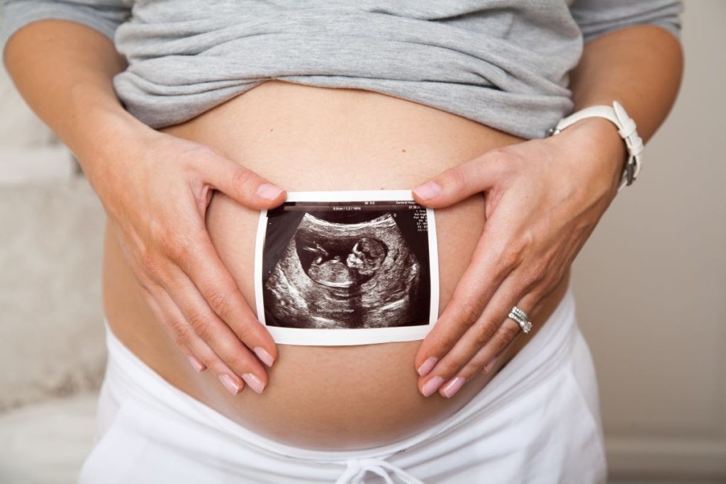 baby scan: what is hynobirthing