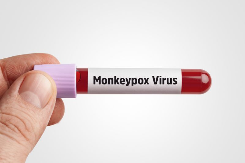 Vial of blood with monkeypox label
